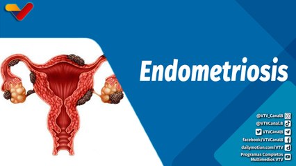 Actitud Saludable | ¿Qué es la endometriosis?