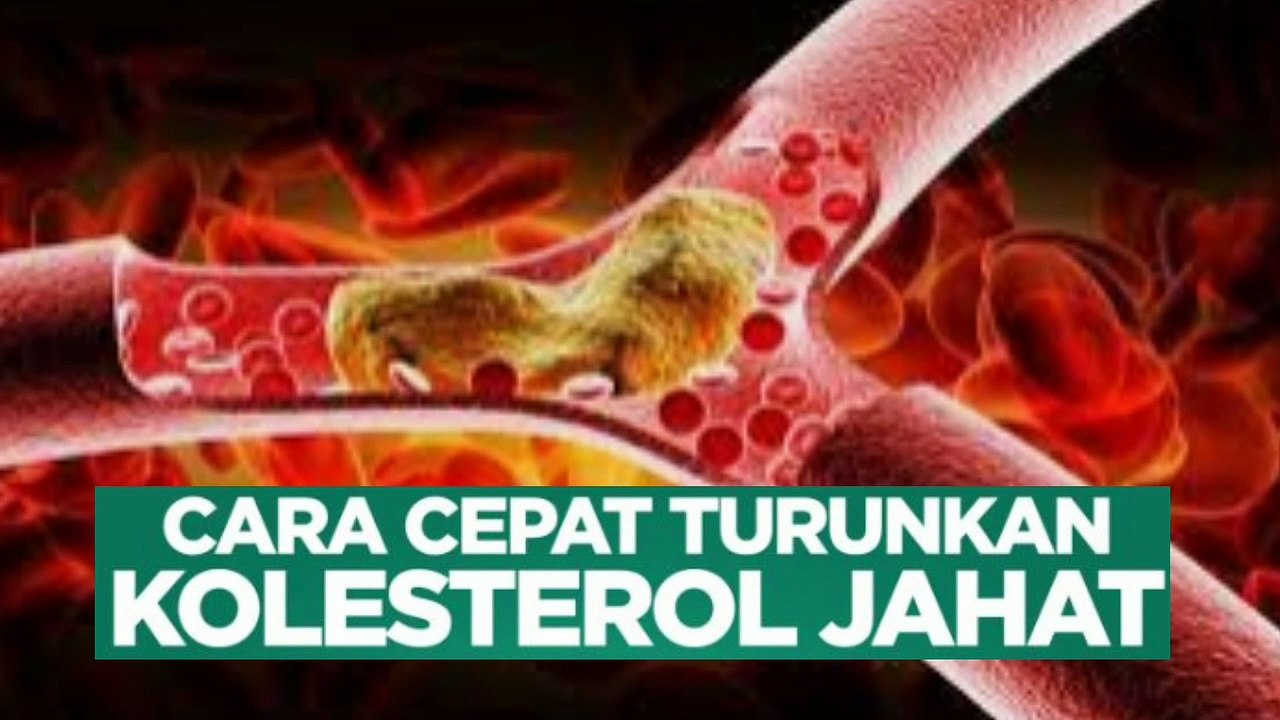 Mudah Dilakukan, Berikut 5 Cara Tercepat Menurunkan Kolesterol jahat