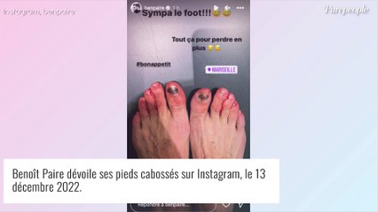 Benoît Paire dévoile une photo ignoble d'une partie de son corps, âmes sensibles s'abstenir...