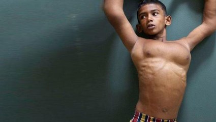 Köyde onun ellerini gören kimse yanına yaklaştırmıyor! Siz de bakınca şaşıracaksınız