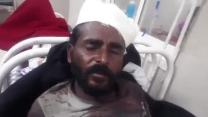 गुना: खेत के पड़ोसी ने किसान के सिर में मारी कुल्हाड़ी, लहुलुहान हालात मे अस्पताल मे भर्ती