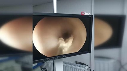 6 aylık kedinin midesinden dikiş iğnesi çıktı