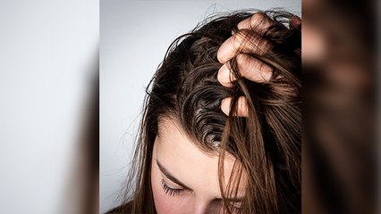 सर्दियों में बाल क्यों हो जाते हैं ऑयली? । ठंड में बाल चिपचिपे क्यों होते है । Boldsky*Lifestyle