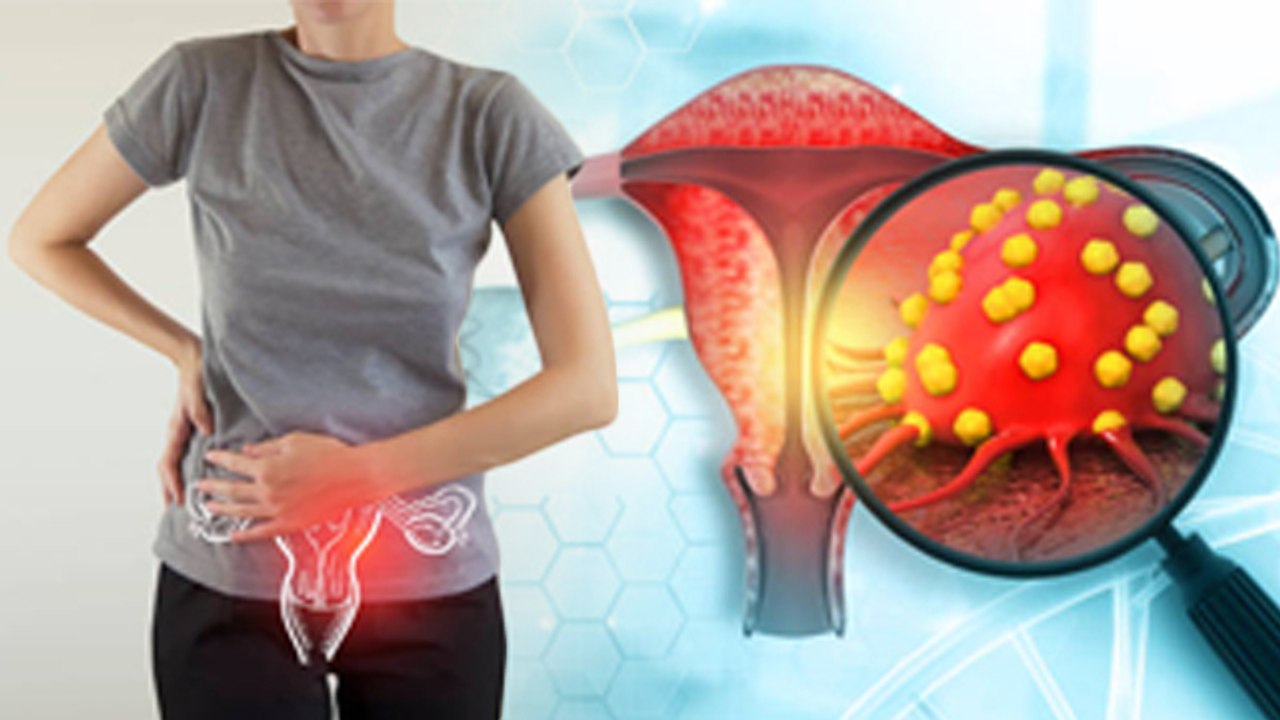 सर्वाइकल कैंसर क्यों होता है ,सर्वाइकल कैंसर के लक्षण जानकर उड़ेंगे होश |Boldsky*Health