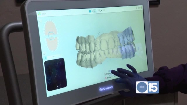 If you're embarrassed by your teeth, you can get a brand-new smile at Smiles By Hanna