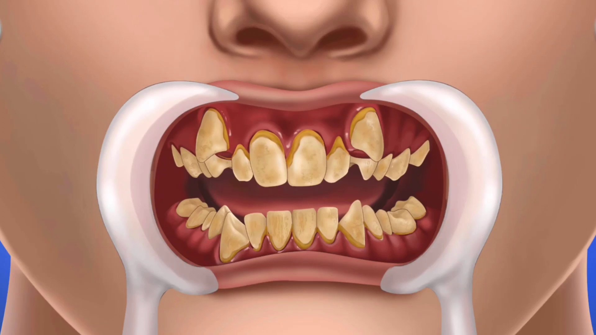 ⁣ASMR Dental Care Treatment | ASMR Treatment Video | ASMR | Dental Treatment  | Well Done ASMR