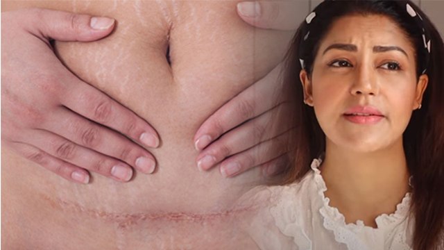 Debina Bonnerjee Second Delivery के बाद किया Dance, C-Section के टांके कितने दिन में होते हैं ठीक |