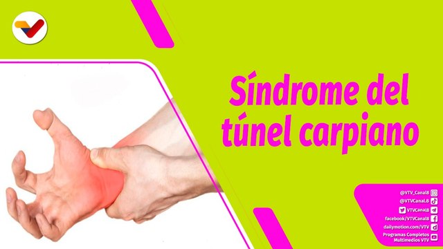 Buena Vibra | ¿Por qué se produce el síndrome de túnel carpiano y cuál es su tratamiento?