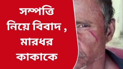 দঃ ২৪ পরগনা: সম্পত্তি নিয়ে বিবাদের জেরে কাকাকে মারধরের অভিযোগ