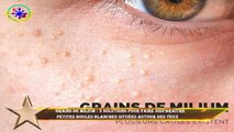 Grains de milium : 3 solutions pour faire disparaître  petites boules blanches situées autour des ye