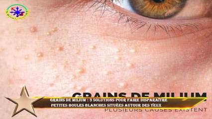 Grains de milium : 3 solutions pour faire disparaître  petites boules blanches situées autour des ye