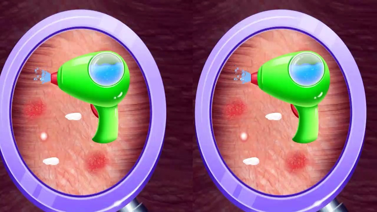 ASMR Head Infections Removal & Hair Care Animation