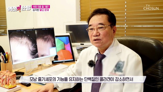 겨울철 유독 빠지는 머리카락 탈모 자가진단 체크리스트 TV CHOSUN 20221216 방송