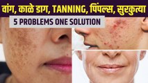 घरच्या घरी बनवा Vitamin C Facepack | Homemade Vitamin C Serum | Skin Brightening Serum