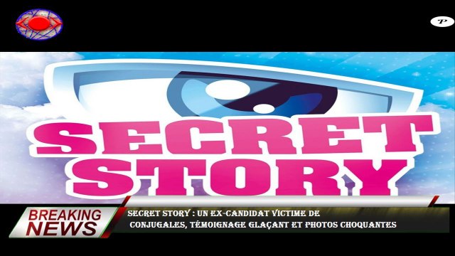 Secret Story : Un ex-candidat victime de conjugales, témoignage glaçant et photos choquantes