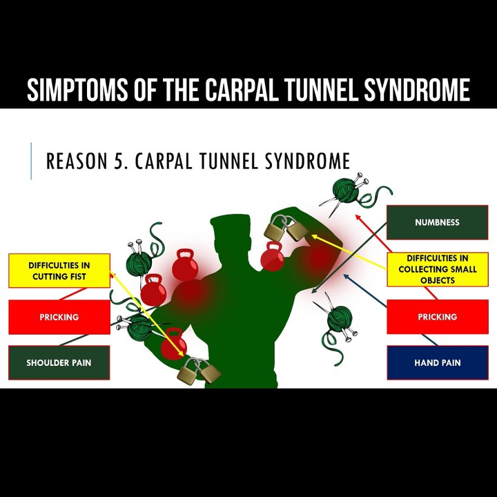 Symptoms of the carpal tunnel syndrome