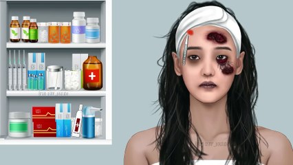 ASMR Eye discharge removal animation - Eyelid big acne extrusion and lashes lice deep cleaning