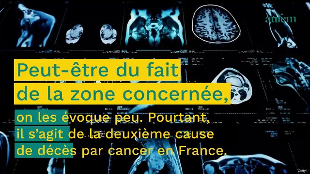 Cancer du côlon : la liste complète des premiers symptômes à surveiller