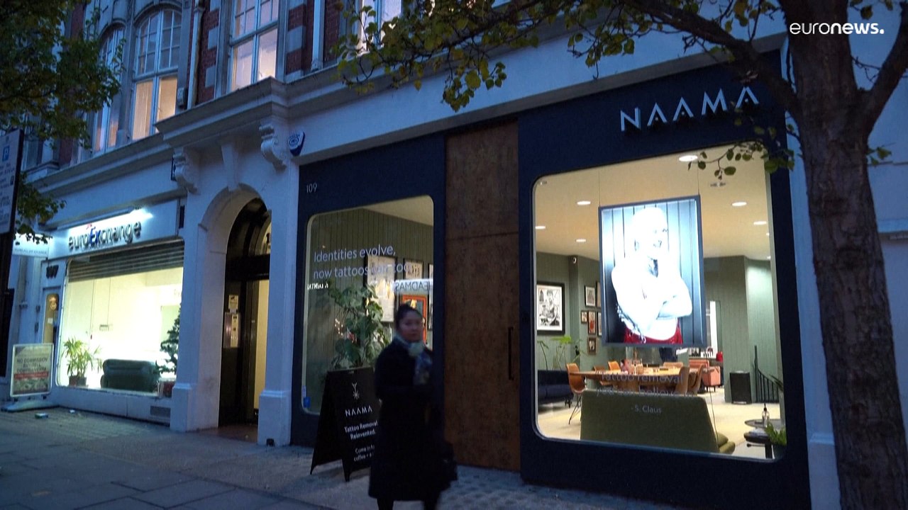 Kanye-West-Tattoo jetzt peinlich? Studio bietet kostenlose Entfernung an