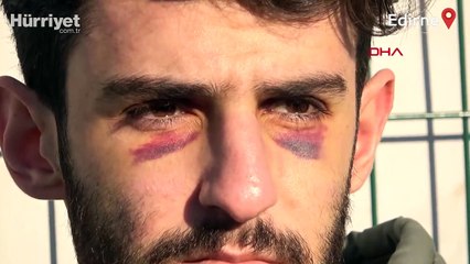 Yunan güvenlik güçleri darp etti