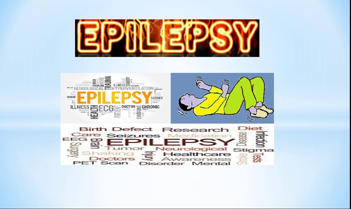 Epilepsy (Seizures)