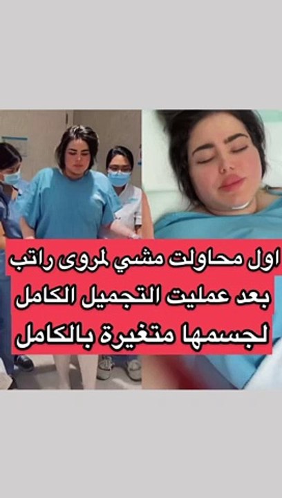 اختلاف في شكل خصرها: مروة راتب تحاول المشي بعد عملية التجميل