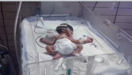 आगरा: आखिरी सांस तक मां के दूध के लिए तड़पता रहा मासूम, इलाज के दौरान हुई मौत