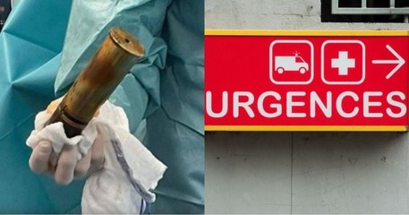 À 88 ans, il se présente aux urgences avec un obus de 14-18 dans le... rectum et provoque l'évacuation de l'hôpital