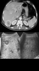 SIGNO DE LA RUEDA DENTRO DE LA RUEDA