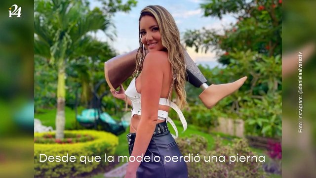 Daniela Álvarez se identifica con una Barbie que tiene prótesis