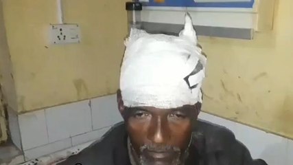 बदायूं:गली में भैंस बांधने को लेकर दबंगों ने युवक को लाठी-डंडों से पीटकर किया घायल