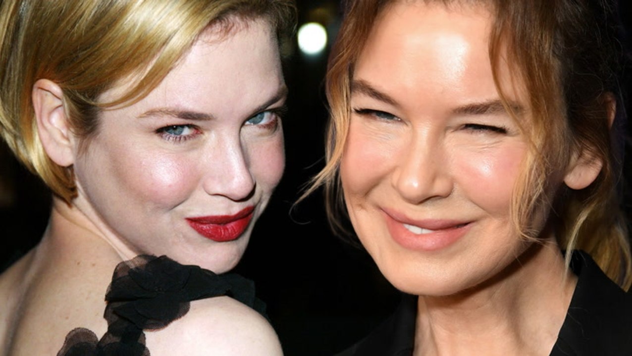 Renée Zellweger: Ihre Hammer-Transformation