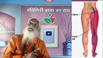 L4,L5, और S1 के बीच दबी हुई साइटिका नाड़ी का बिना ऑपरेशन बिना दवा, मंत्र शक्ति से (ताबीज) द्वारा इलाज।