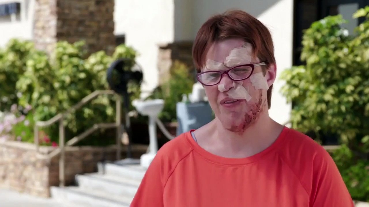 Dr. Pimple Popper - Se5 - Ep01 - Leave it to the Nevus HD Watch