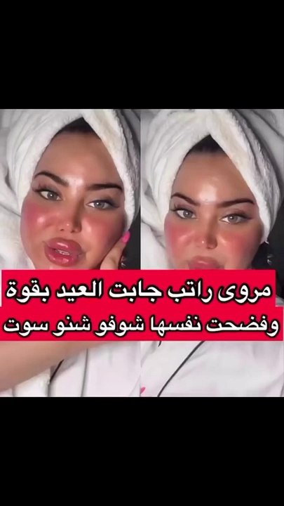 مروة راتب تتغزل بنفسها من جديد والجمهور يكشف استخدامها فلتر