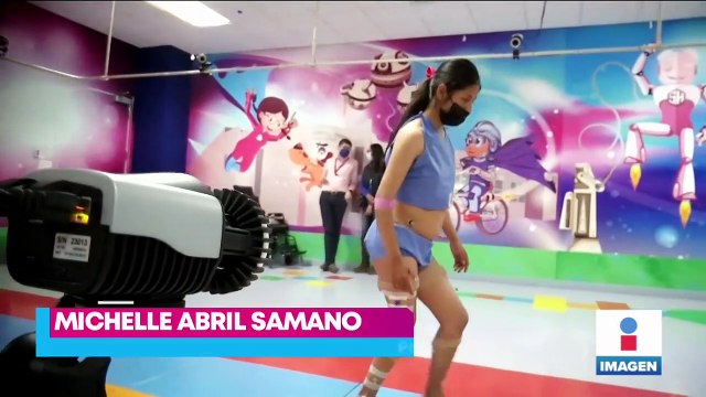 Hospital Shriners atiende a pacientes con problemas ortopédicos con ayuda de tecnología