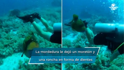 “Pensé que me rompería la piel”: Buzo cuenta cómo fue mordido por un pez con dientes humanos