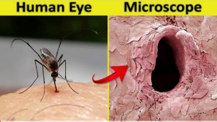12  Things You Can See Only Under Microscope   ll