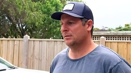 Police investigating after woman suffers severe burns