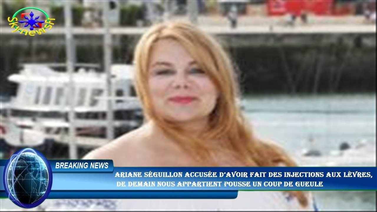 Ariane Séguillon accusée d’avoir fait des injections aux lèvres,  de Demain nous appartient pousse u