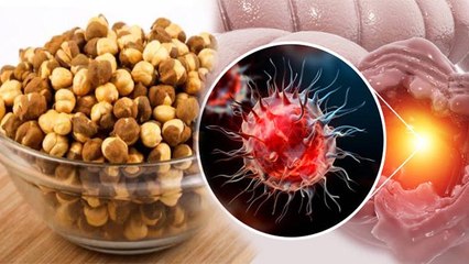 किस बीमारी में चना नहीं खाना चाहिए, पथरी में चना खाने से क्या होता है |Boldsky*Health