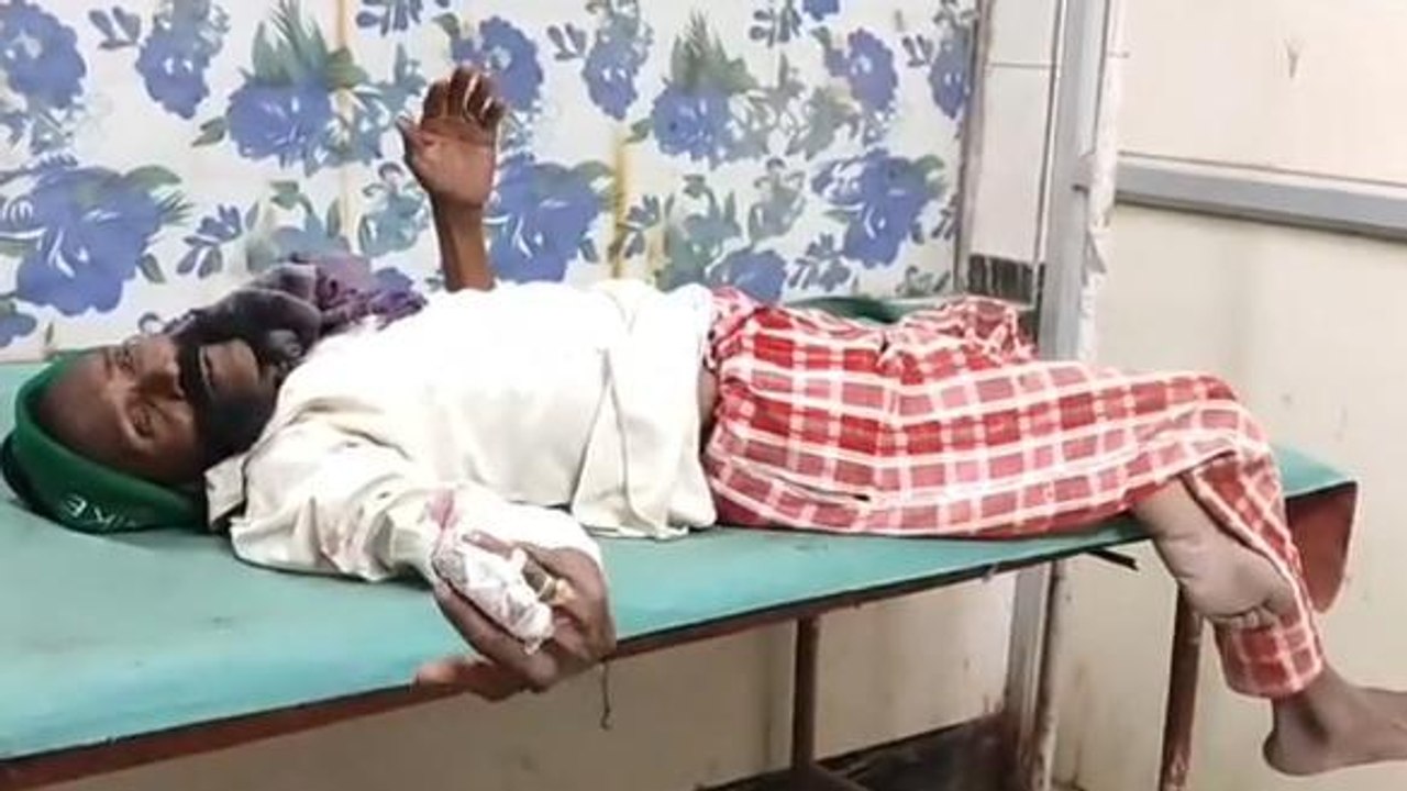 अमरपाटन:मामूली बात को लेकर दो पक्षों में हुआ विवाद,डंडे के हमले से एक व्यक्ति हुआ घायल