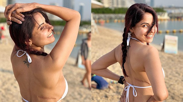 Chhavi Mittal Breast Cancer के बाद Bikini में Flaunt किया Surgery Scar | Boldsky*Entertainment
