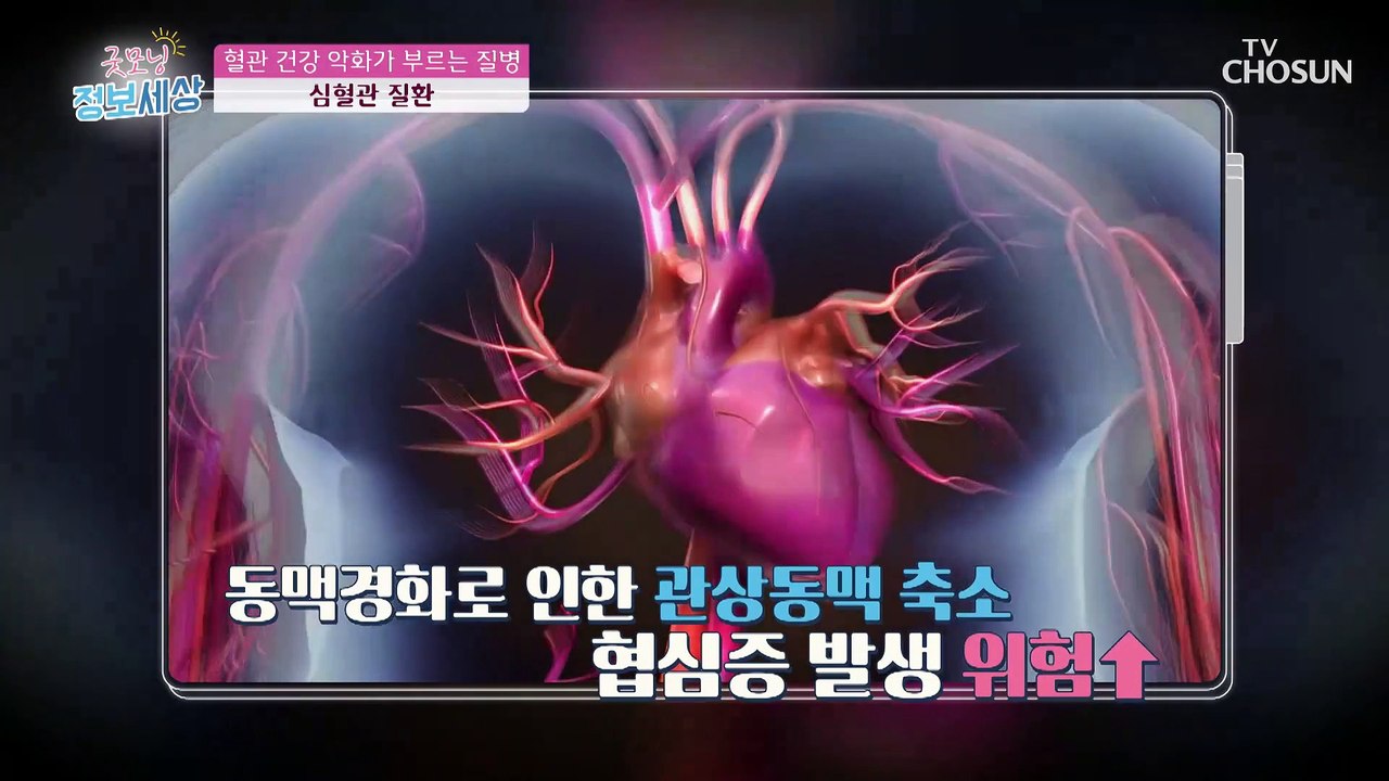 혈관이 망가졌을 경우 발생하는 질병들이 따로 있다!? TV CHOSUN 221229 방송