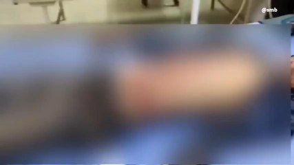 ಬೀದರ್: ಆಟೋ ಪಲ್ಟಿ, ಯುವಕ ದಾರುಣ ಸಾವು: ಇಬ್ಬರು ಗಂಭೀರ