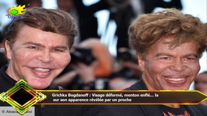 Grichka Bogdanoff : Visage déformé, menton enflé... la  sur son apparence révélée par un proche