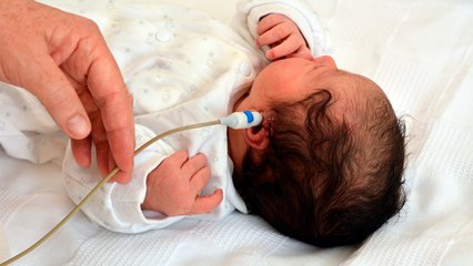 bd-tamizaje auditivo-en-el-recien-nacido-291222