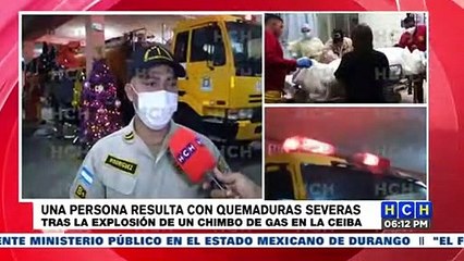 Mujer resulta con severas quemaduras tras explosión de "chimbo" en La Ceiba