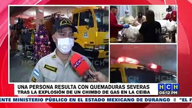 Mujer resulta con severas quemaduras tras explosión de chimbo en La Ceiba