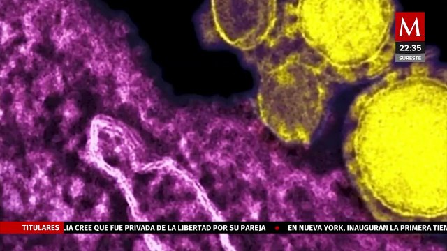 Joven contrajo viruela del mono tras convivir con un amigo contagiado en CdMx